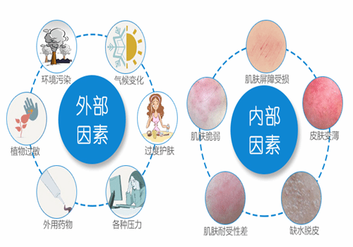 敏感性肌肤