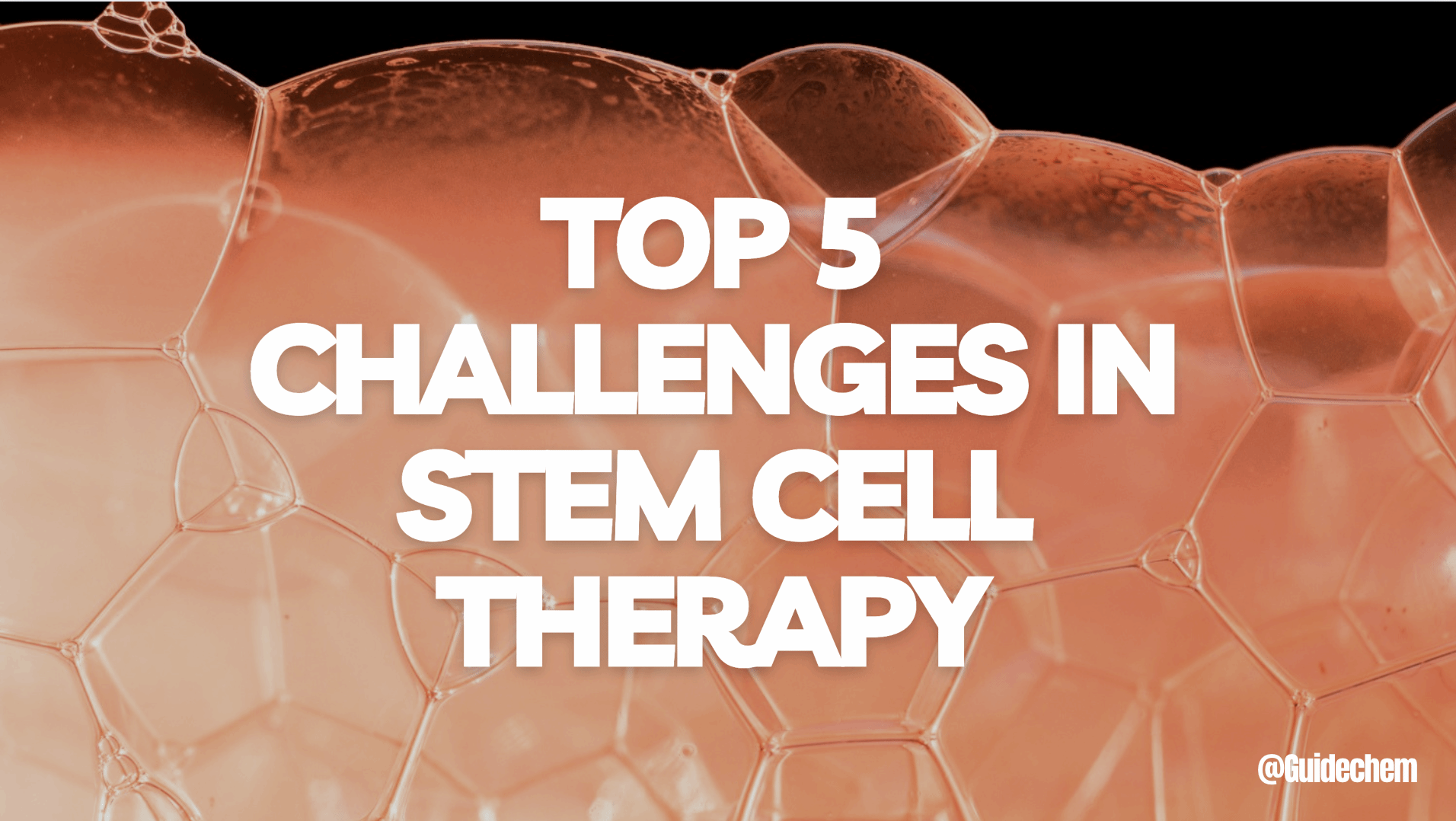 Stem Cell Therapy: 5 Major Challenges